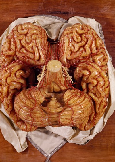 Model of a brain by Clemente Susini